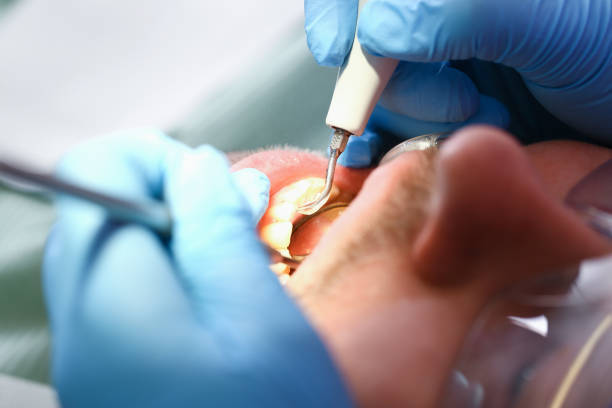 Best Emergency Treatment for Dental Infections or Abscesses in Gra Forks Af, ND