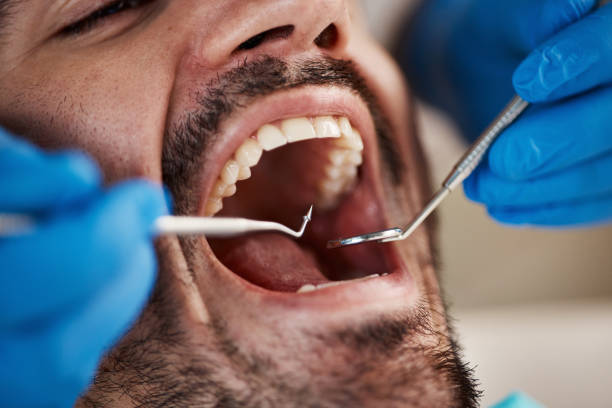 Best Emergency Dental Care for Broken or Chipped Teeth in Gra Forks Af, ND